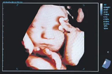 US moves to protect unborn children